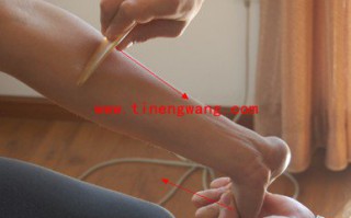 手指肌腱炎的康复方法 手指肌腱炎的康复方法